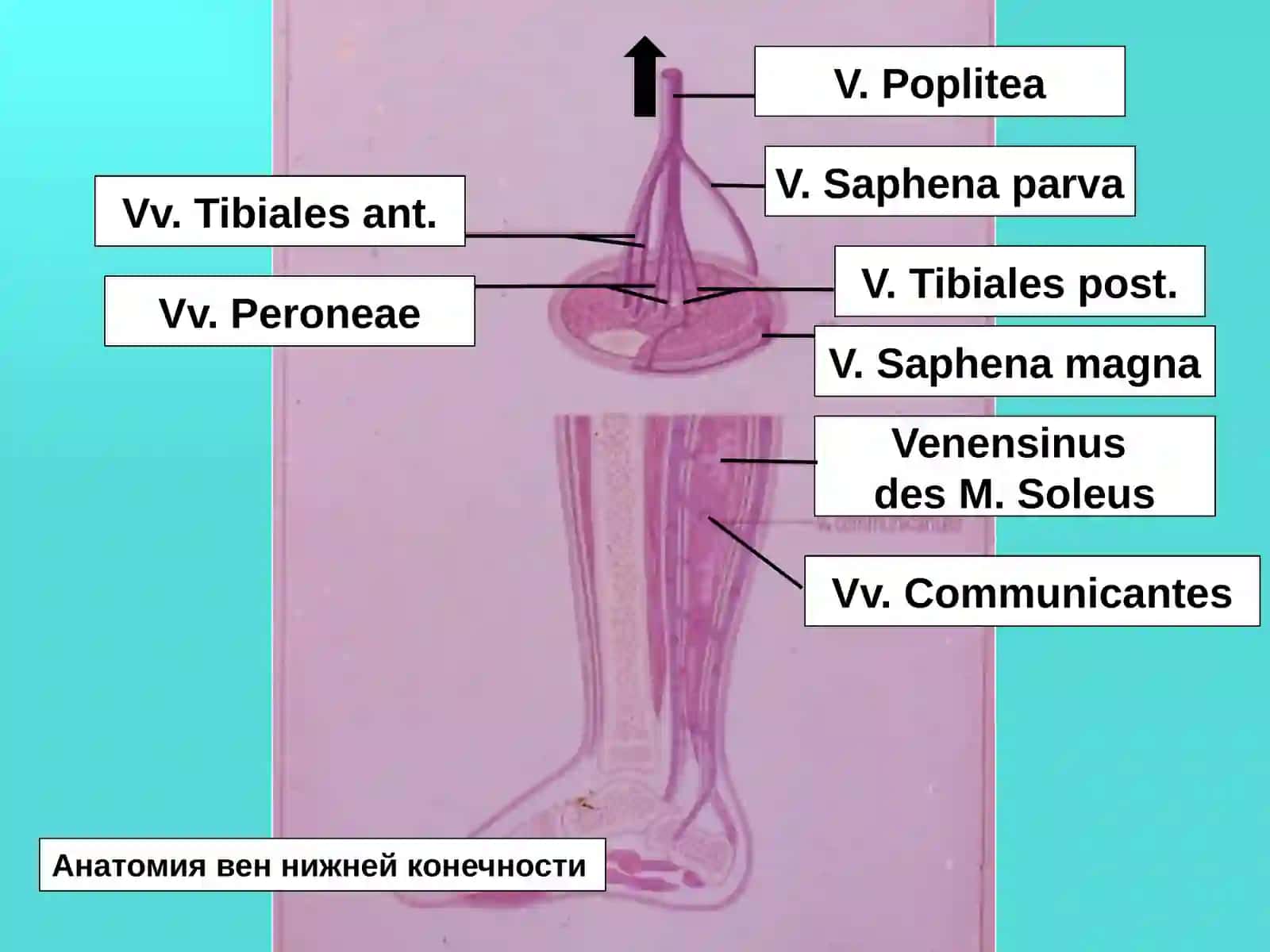 Oyoq venalari varikoz kasalligi: zamonaviy jarrohlik va mini-invaziv davolash usullari 4