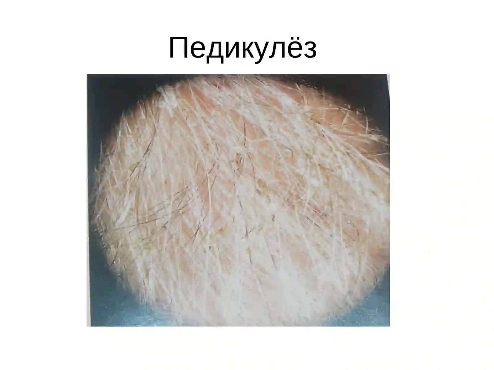Битлаш 4