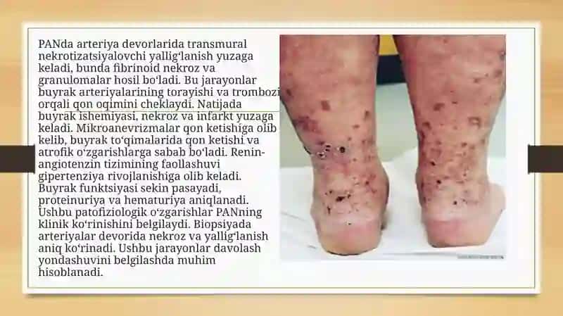 Nefrologiya fanining mustaqilishi 4