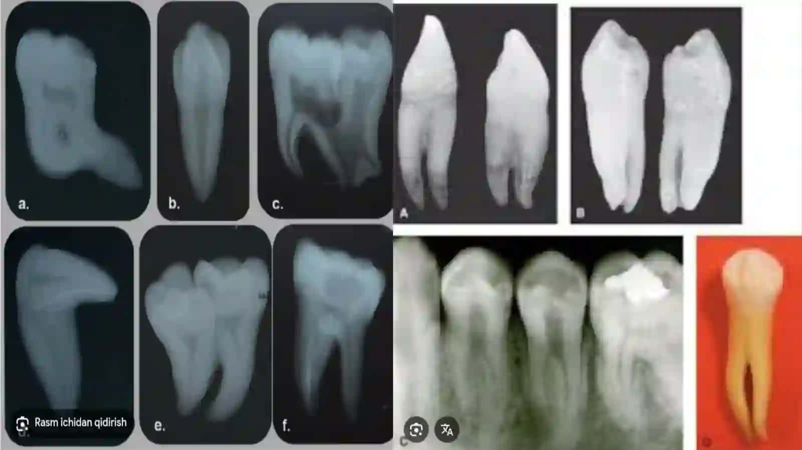 TISH VA JAG‘LARNI RENTGENOLOGIK TEKSHIRISH USULLARI 4