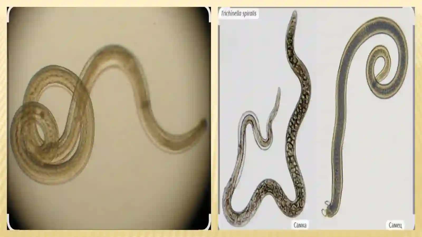 Trixinella(Trichinellaspiralis).Rishta(Dragunculusmedinensis) 4