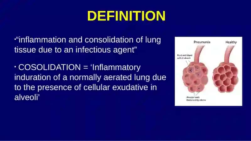 Pneumonia 4