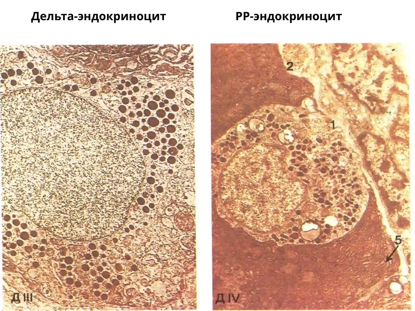 Меъдаостибези 4