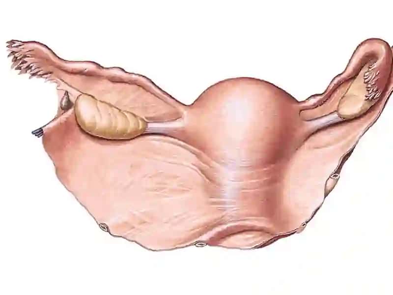 CLASSIFICATION OF FEMALE GENITALS: 4
