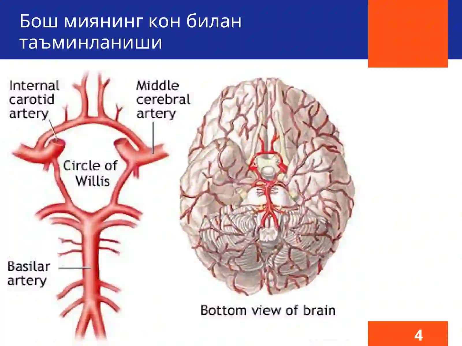 Бош мия ишемияси 4