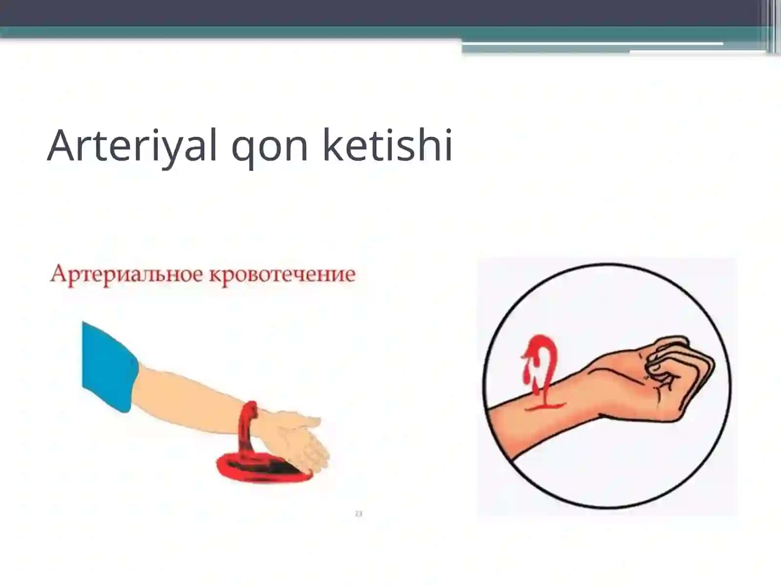 Qon ketishi va qon yo’qotish 4