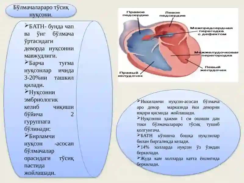 Туғма Юрак Нуқсонлари 4