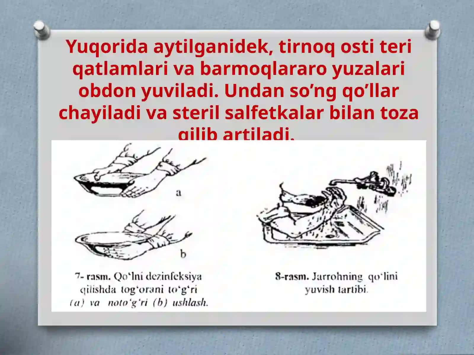 Operatsiyaga tayyorgarlik ko’rish. Xirurg qo’lini Spasokukoskiy-Kochergin usulini qo’llash 4