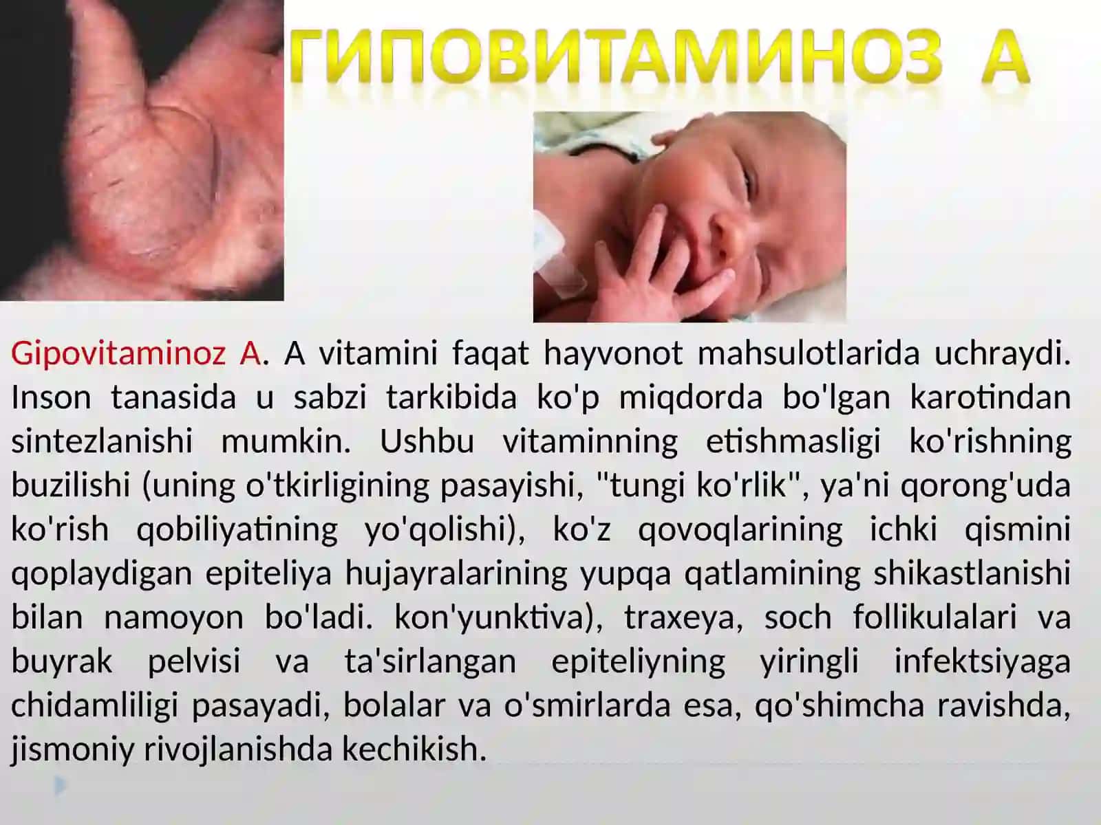 Гиповитаминозы 4