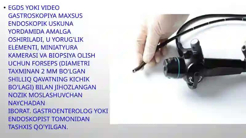 Fibrogastroduodenoskopiya(FGDS, EGDS) 4