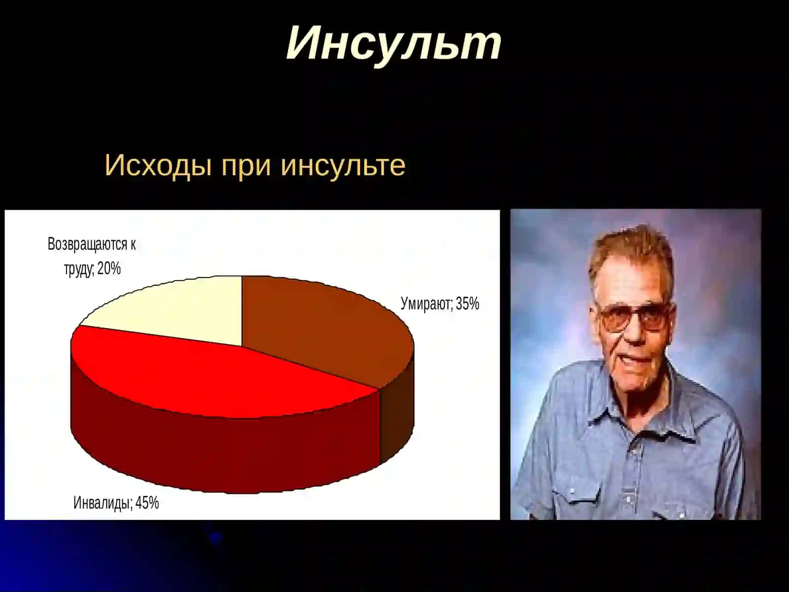 Инсулт 4