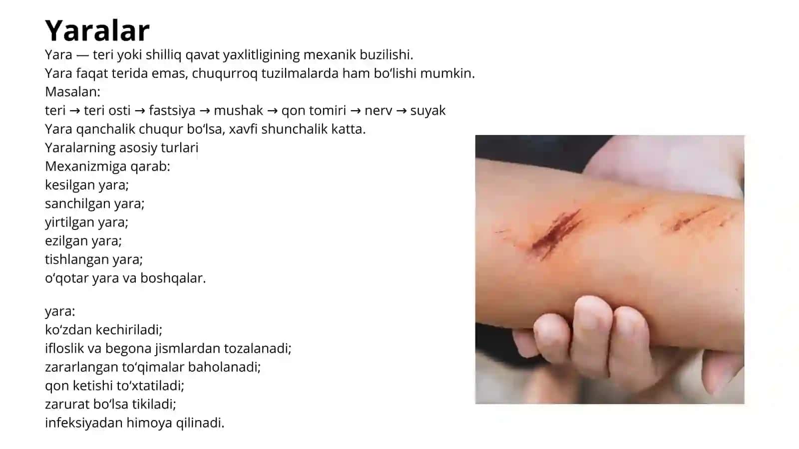 Shikastlanishlar 4