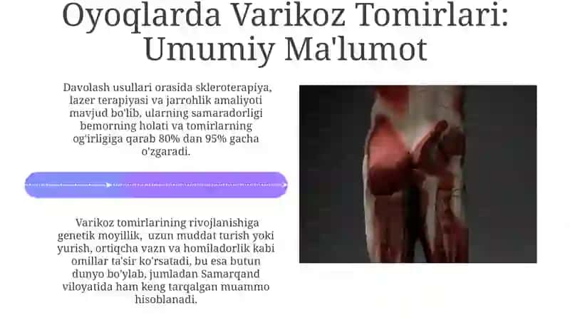 Oyoqlardagi varikoz 4