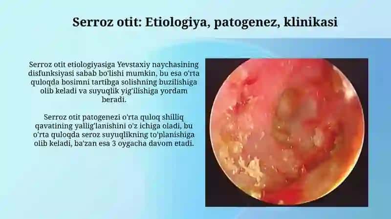 Noyiringli otitlar 4