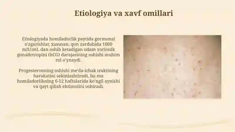 Homiladorlar ko'ngil aynishi va qusishi 4