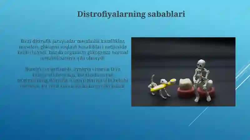 Distrofiyalar turlari sabablari rivojlanishi mexanizmi 4