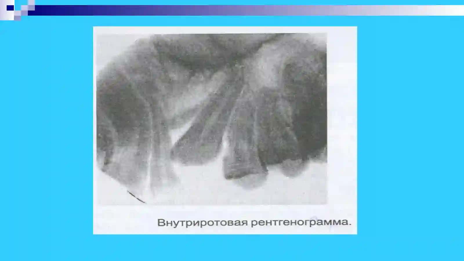 Ортодонтия ва тишларни протезлаш кафедраси 4