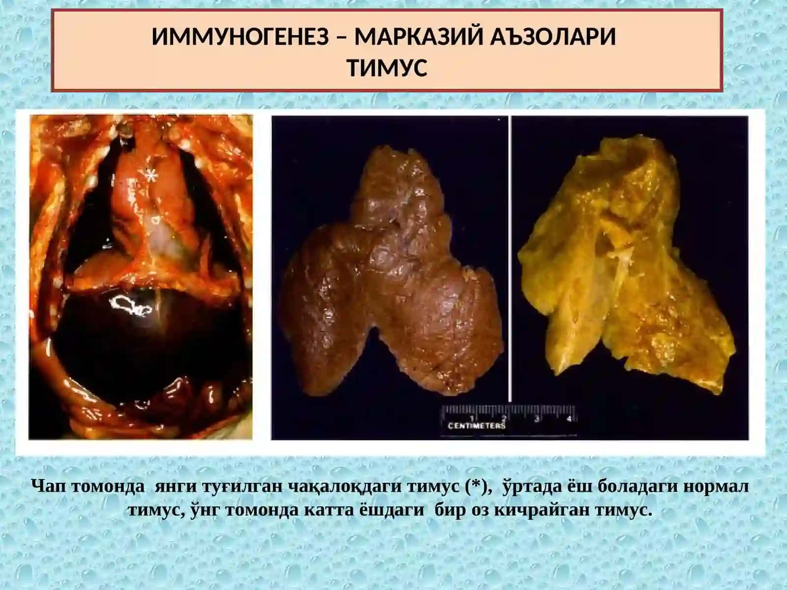 Патологик анатомия фани 4