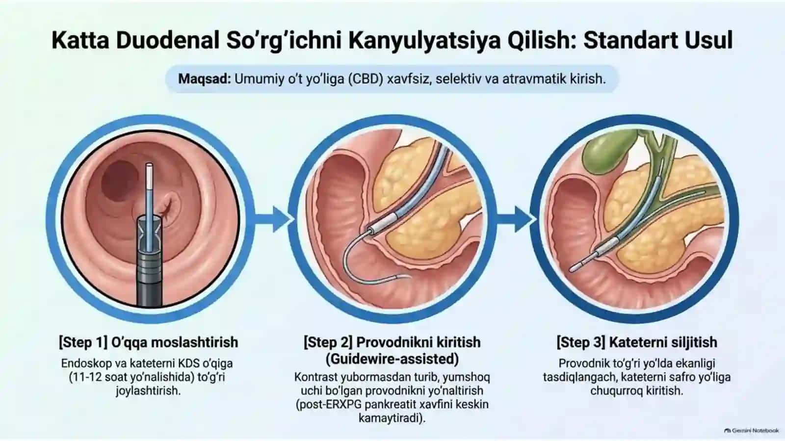 ERXPG va transpapillyar aralashuvlar — 15 slaydli taqdimot 4