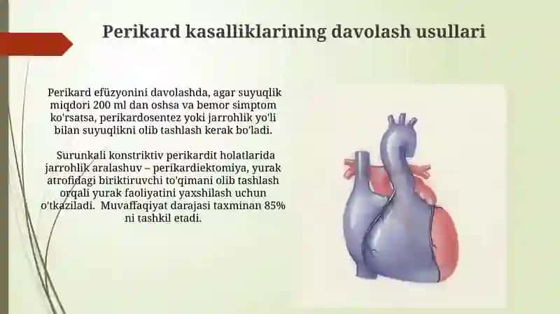 Perikard kassaliklari va yurak oʻsmalari 4