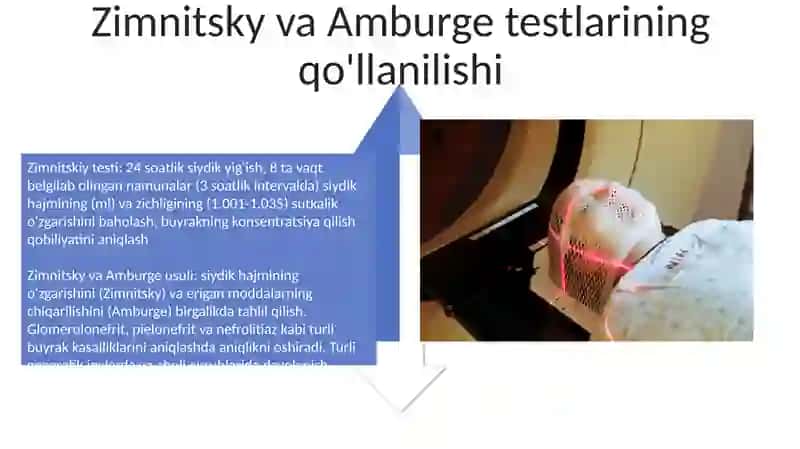Zimnitskiy va Amburje usulida siydik tahlillarini baholash 4