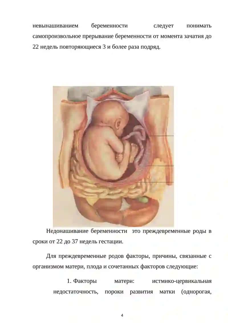 ПРЕЖДЕВРЕМЕННЫЕ РОДЫ 4