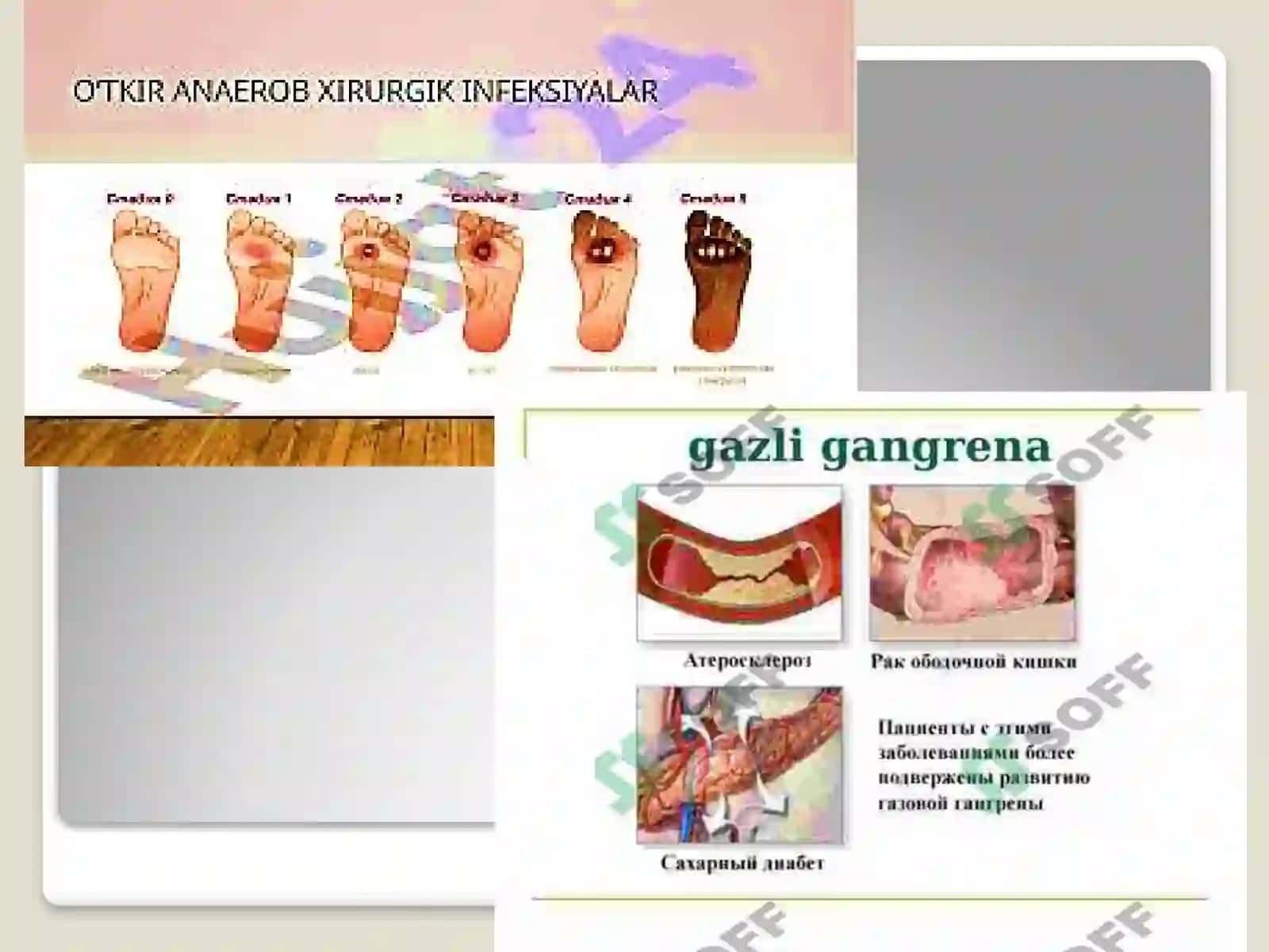 O'tkirana erob infeksiyalar 4