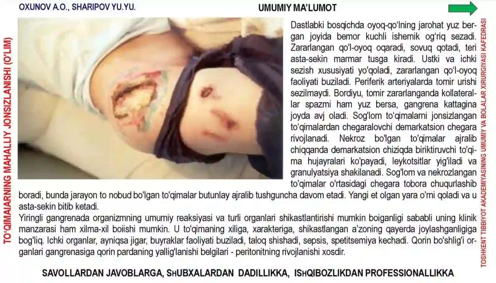 Qon Tomirlar Obliteratsiyalanuvchi Kasalliklari 4