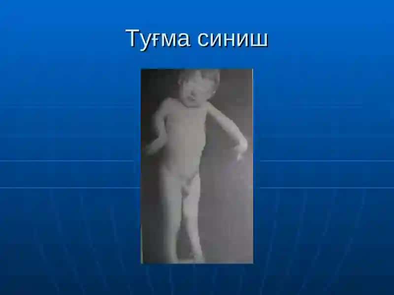 Суякларнинг синиши ва чикиши 4