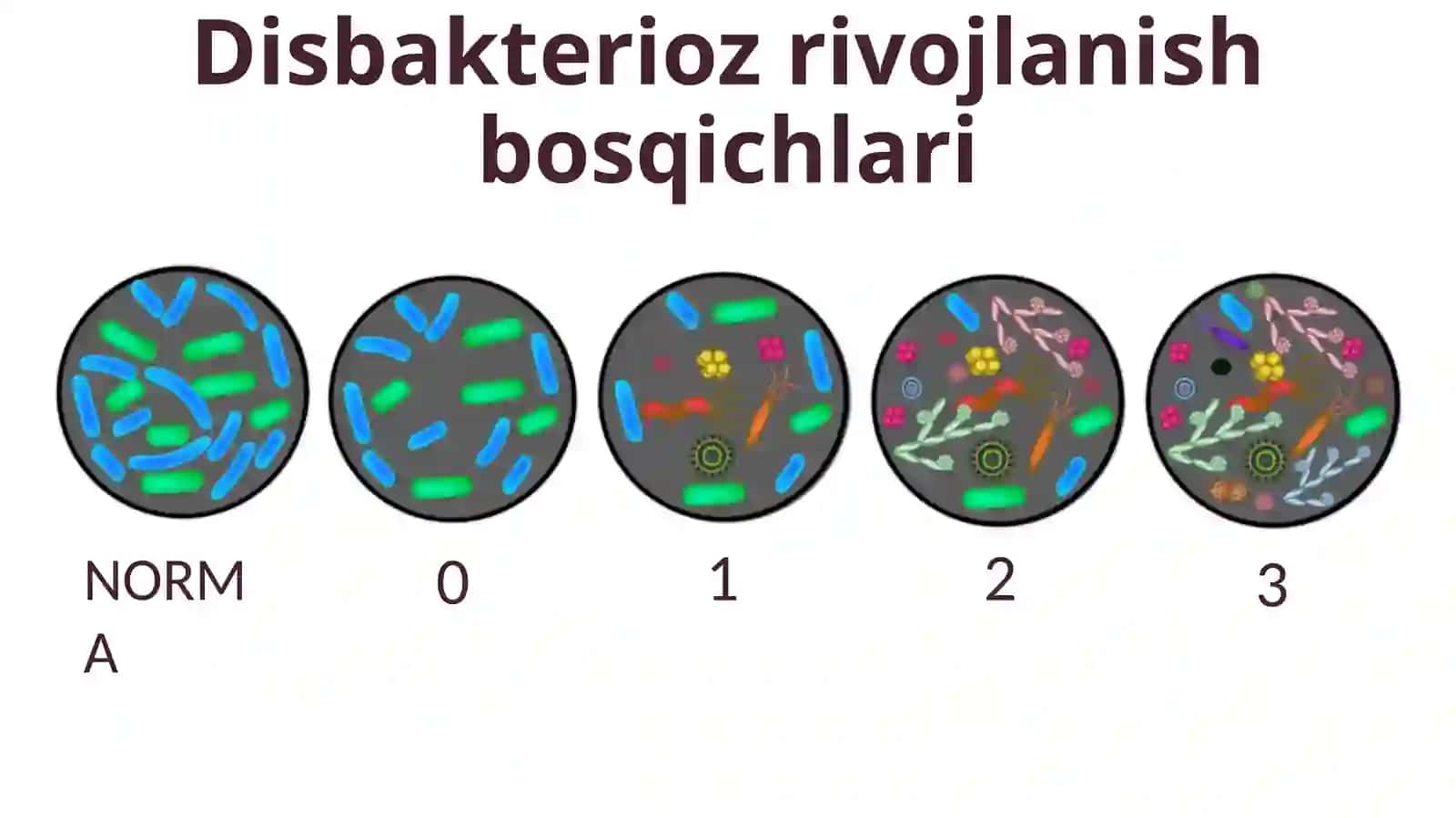 Ichak disbakteriozi etiologiyasi va diagnostikasi (2-variant) 4