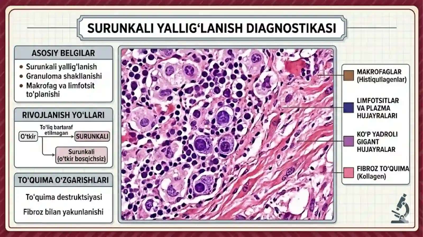SURUNKALI YALLIG'LANISH PREZENTATSIYA 4