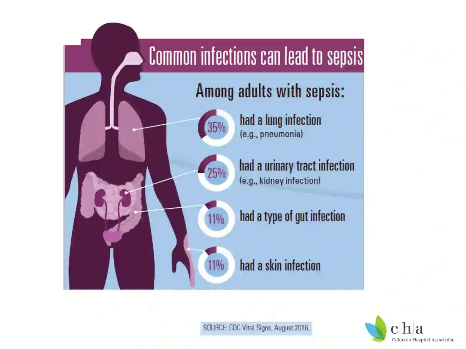 Sepsis 101 4