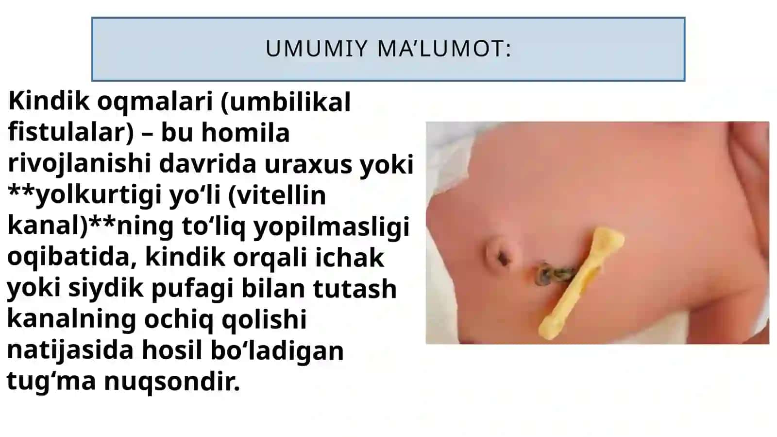 Kindikoqmalari 4