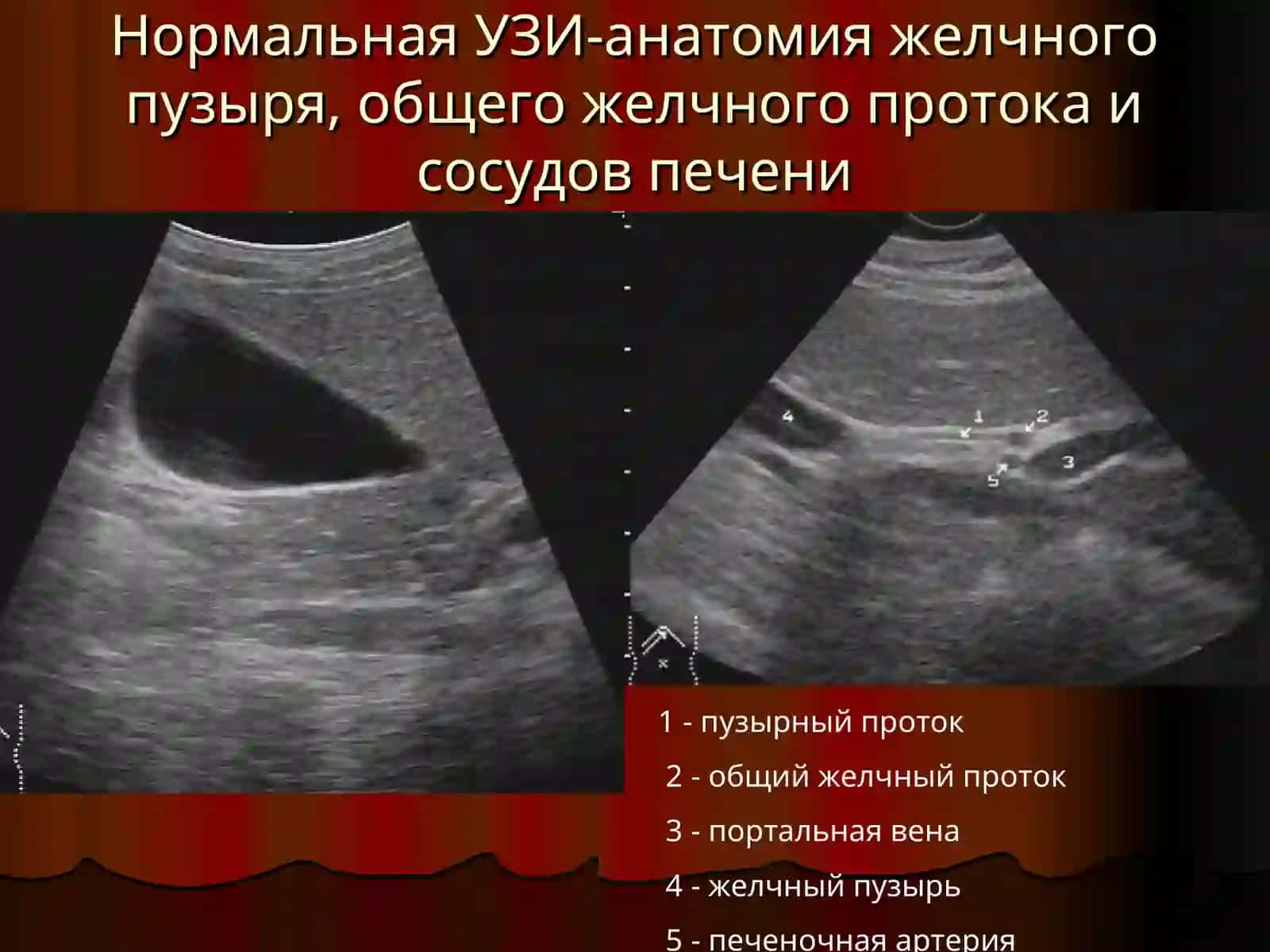 Лучевая диагностика заболеваний печени и желчевыводящих путей 4