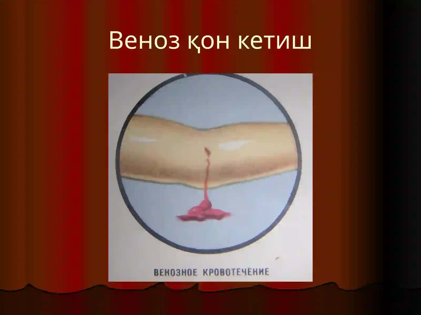 Қон кетиш 4
