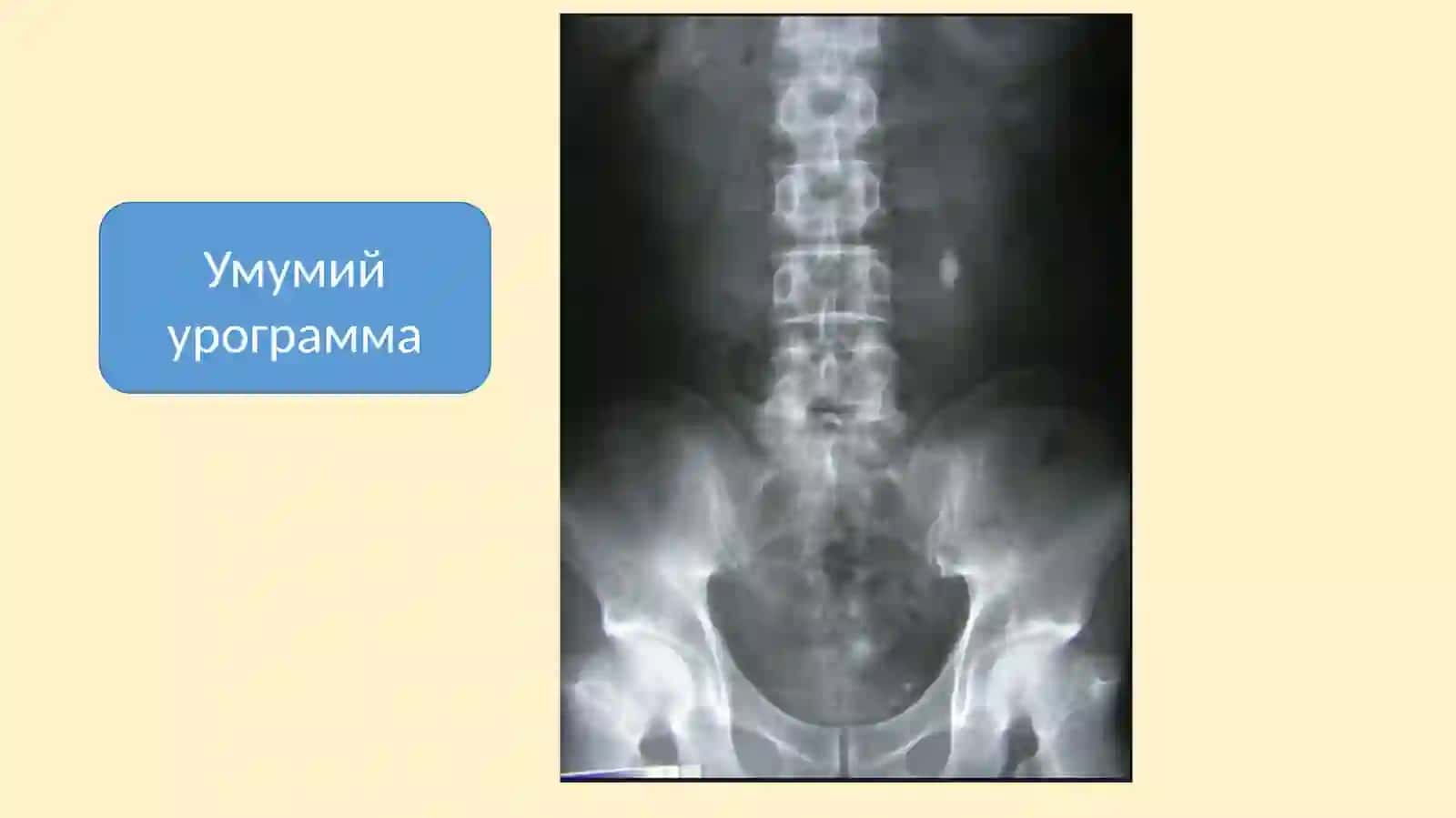 Урологияда рентгенорадиологик техсирис усуллари 4