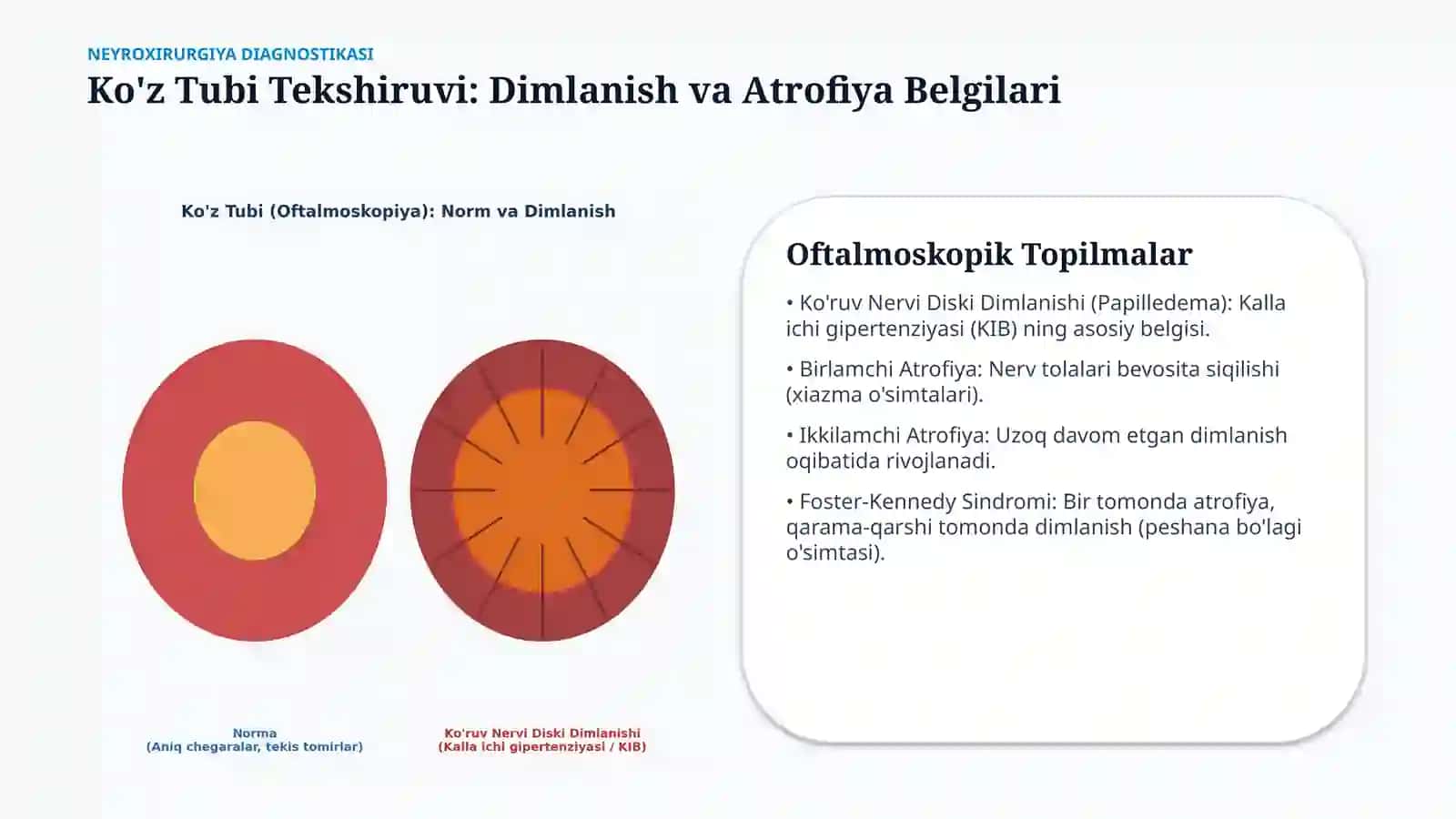 Neyroxirurgiyada otonevrologik va oftalmologik tekshiruvlar — 15 slayd 4