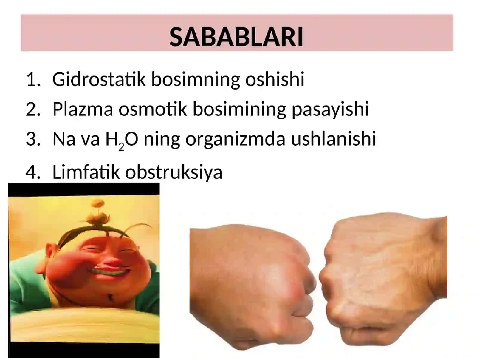 Shish va Giperemiya 4