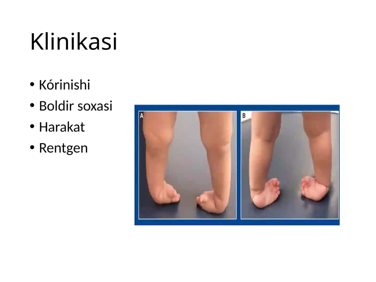Maymoqlik 4