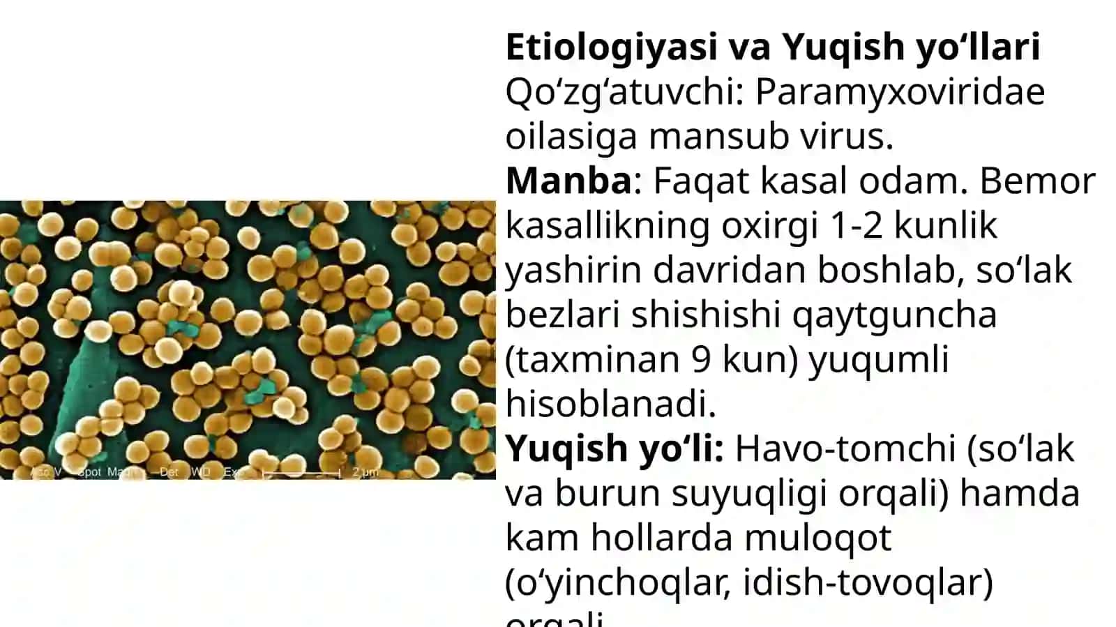 Epidemik parotit 4