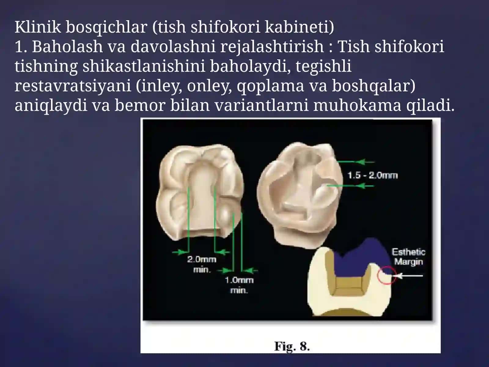 Metallqistirmalarni ishlab chiqarishning klinik va laborator bosqichlari 4