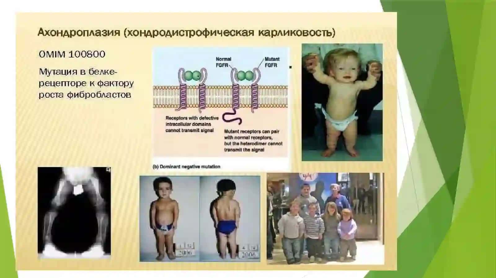 AXONDROPLAZIYA 4