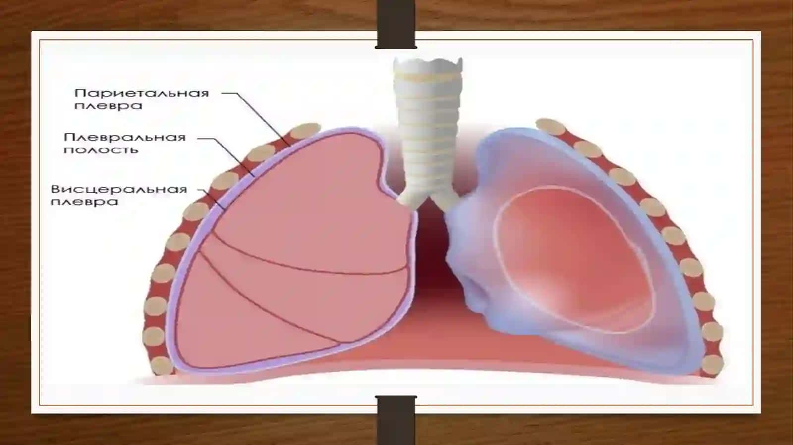 Plevritlaretiologiya 4