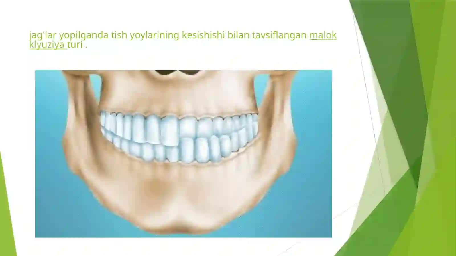 Ikki tomonlama Kesishgan prikus 4