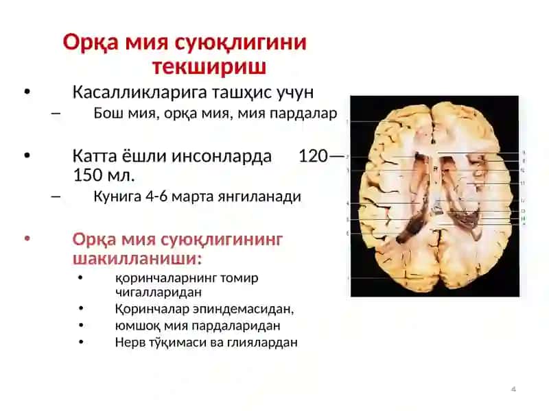 НЕВРОЛОГИК КАСАЛЛИКЛАРДА ҚЎШИМЧА ТЕКШИРИШ УСУЛЛАРИ 4