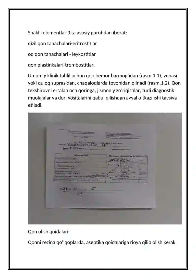 Qon surtmasini tayorlash 4