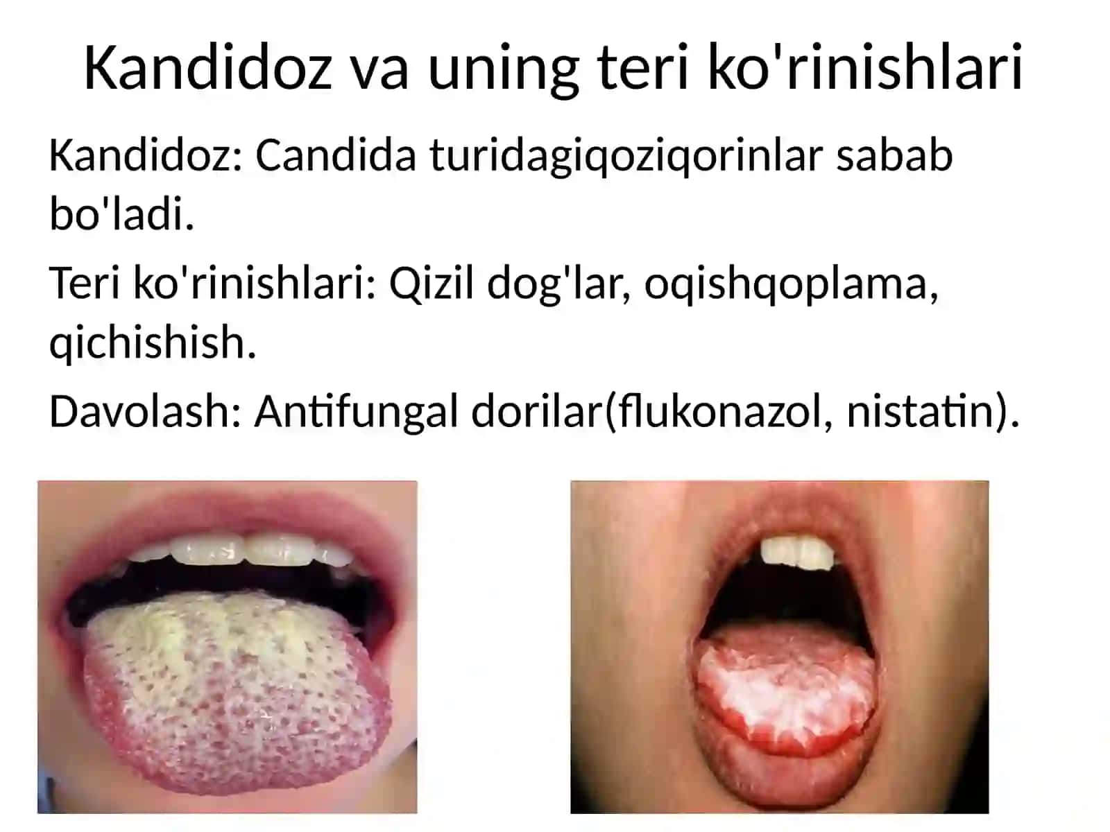 OITS va immunitet 4