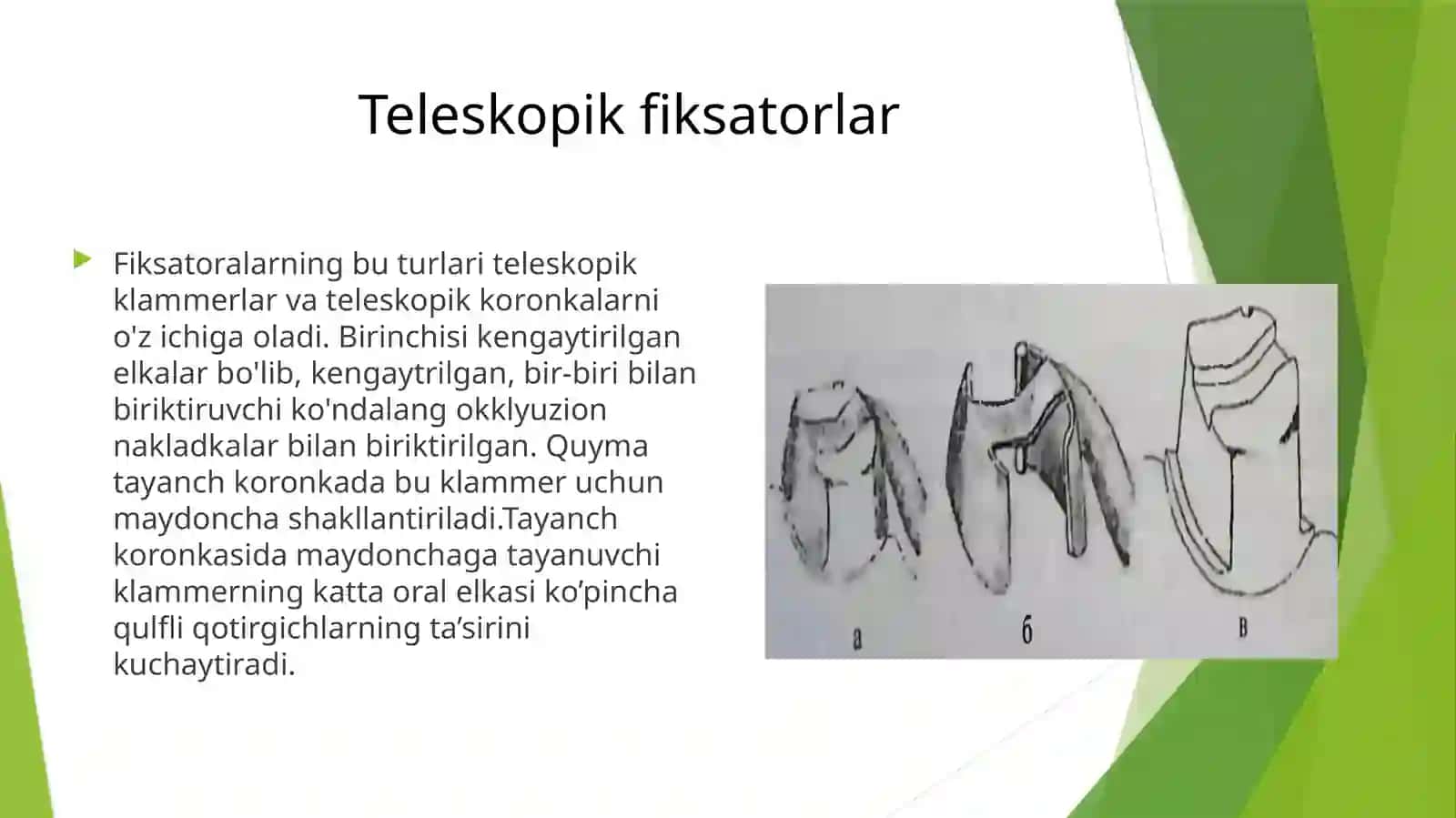 Umumiy amaliyot shifokor-stomatologining bitta saqlanib qolgan tish bilan protezlashda an'anaviy va raqamli texnologiyalar usullarini bilishi. Magnit, teleskopik, to'sinli va qulflifiksatsiyatizimlariga ega bo'lgan yechiladigan tish protezlarini tayyorlash 4