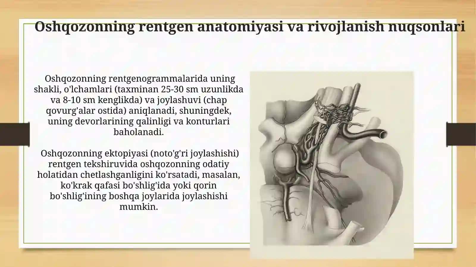 Hazm a'zolarini rentgenanatomiyasi va rivojlanish nuqsonlari 4