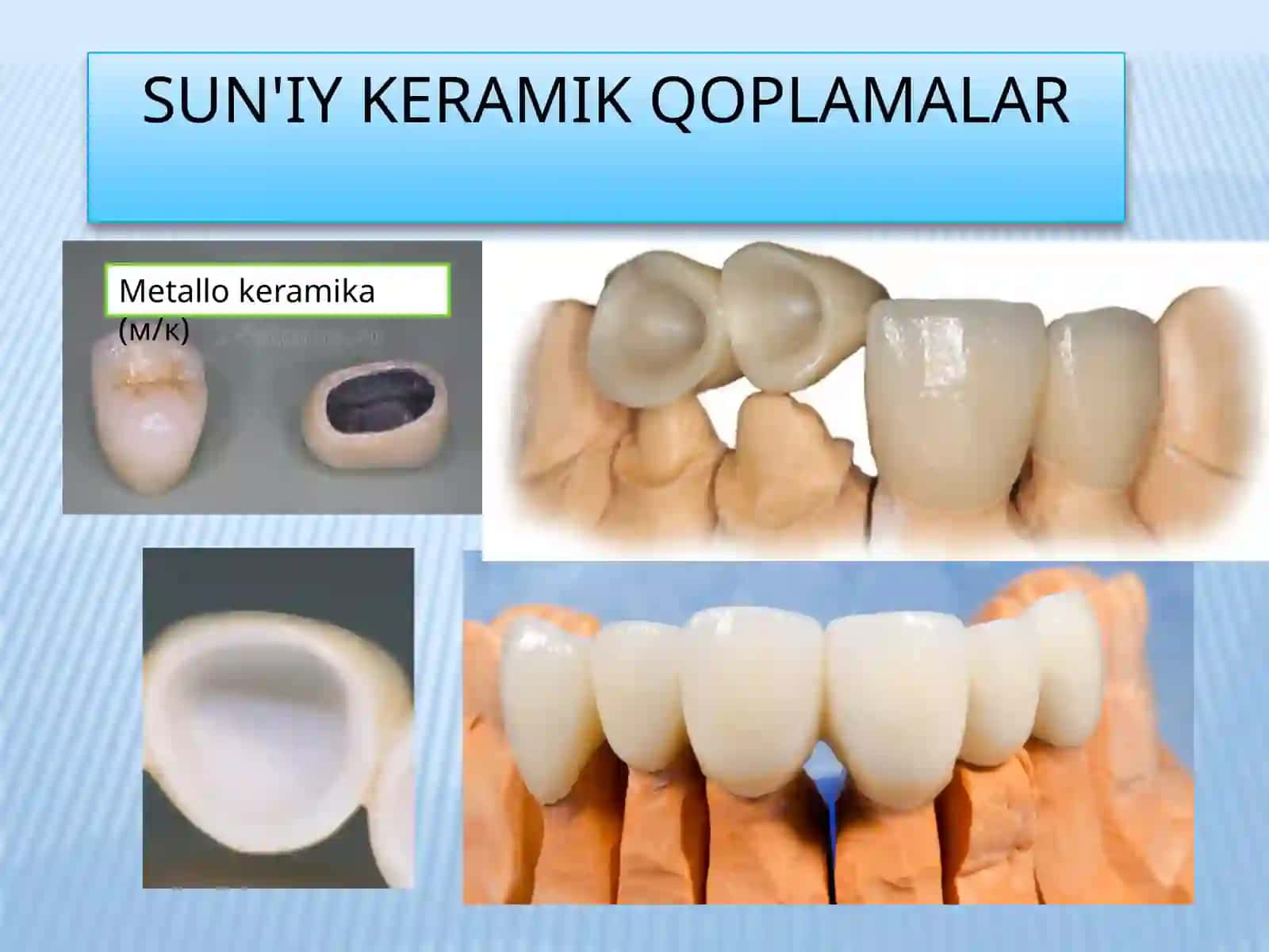 Sirkoniydioksidstomatologikkeramikafarfor 4